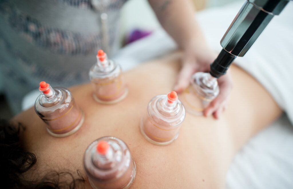 Bekam treatment