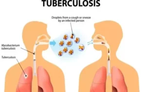 Indonesia PPTI Tuberculosis Cases