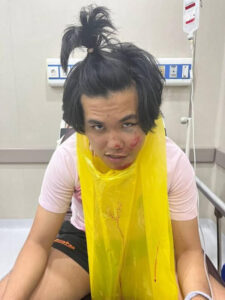 Singaporean Student Suffers Fracture Memory Loss After ATV Incident in Bali 
