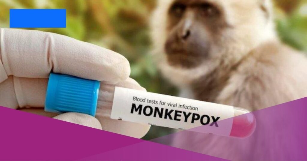 monkeypox